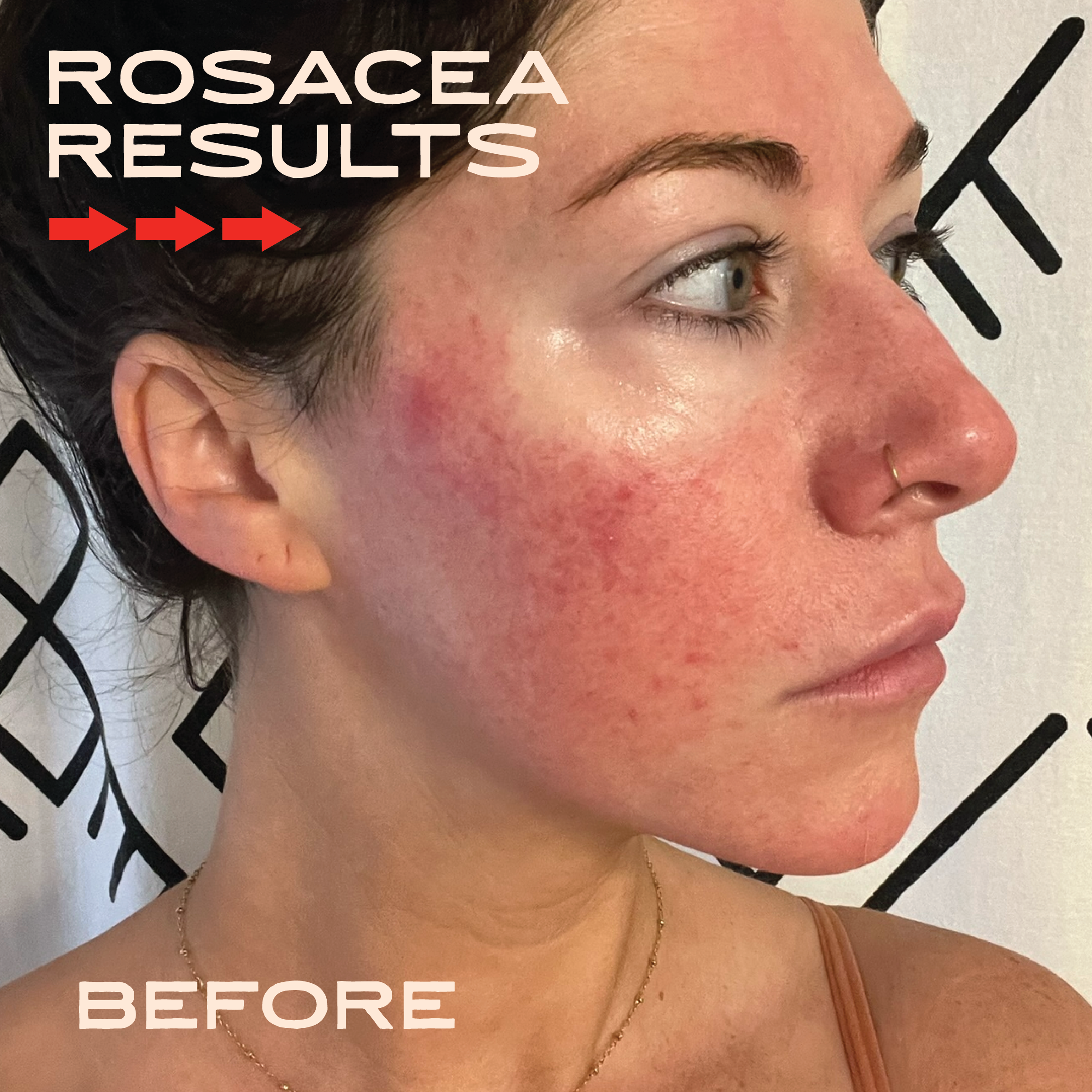 Tallow Face Balm | Natural Blue Tansy Skincare Moisturizer - The BLVD