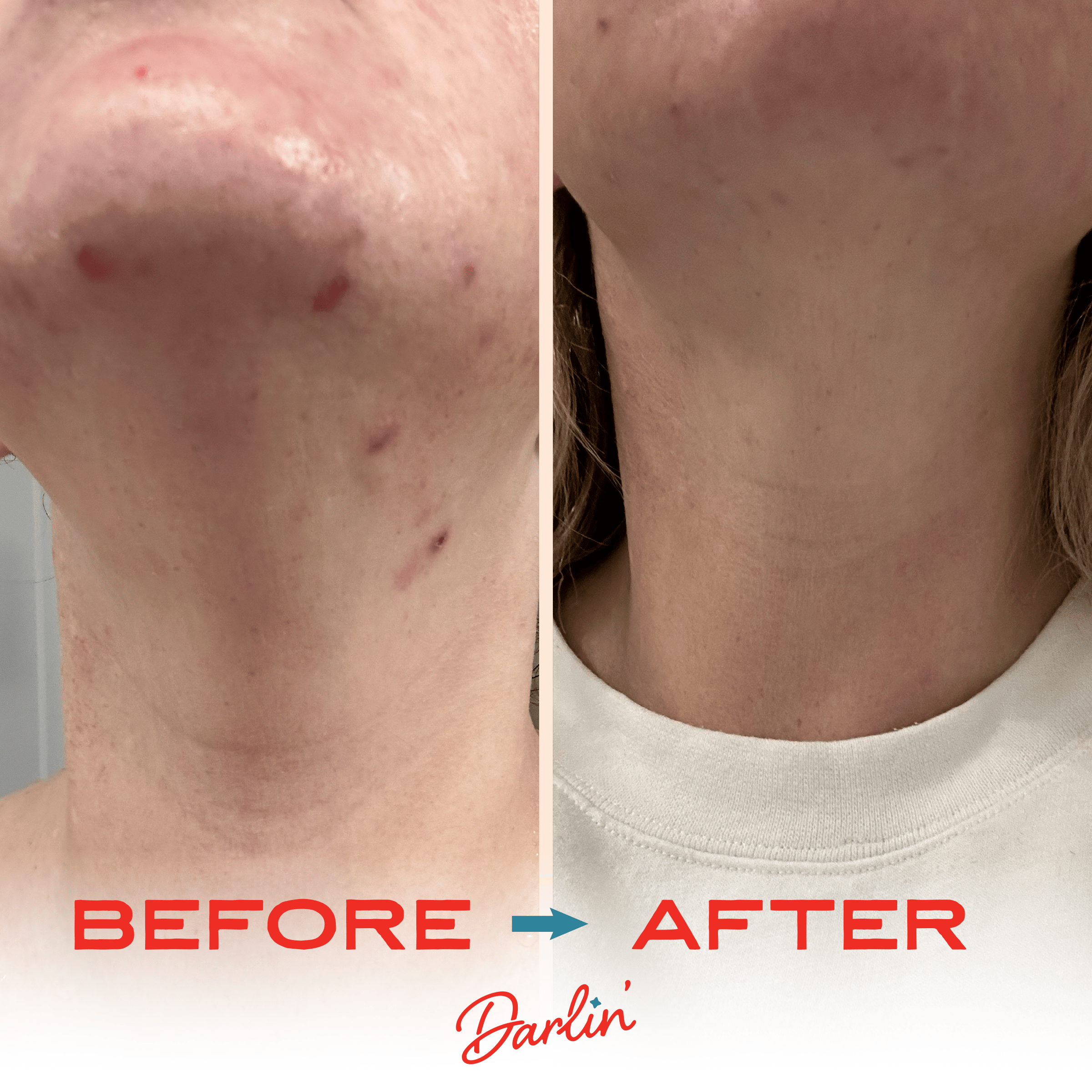 Tallow Face Balm | Natural Blue Tansy Skincare Moisturizer - The BLVD