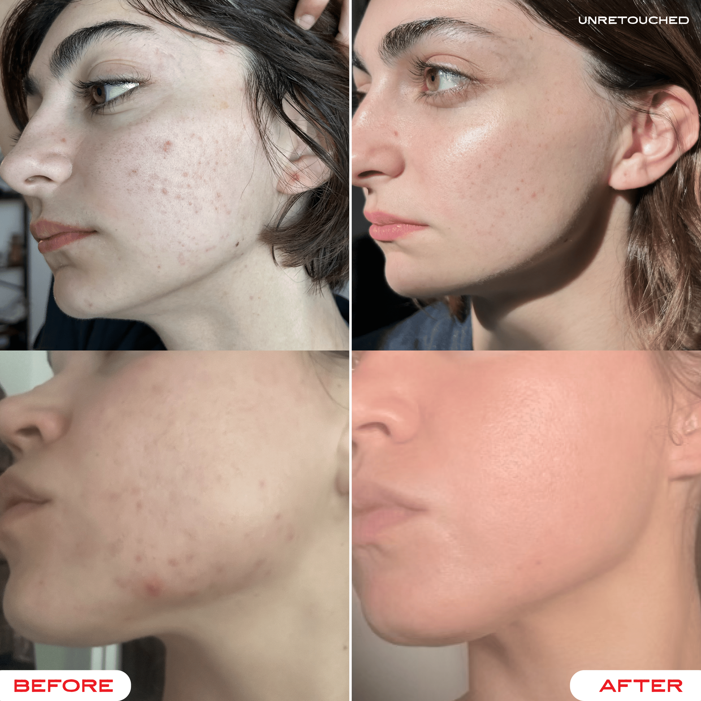 Tallow Face Balm | Natural Blue Tansy Skincare Moisturizer - The BLVD